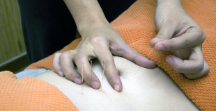 Mutuelle santé senior avec prise en charge acupuncture : prix et devis