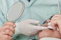 Dentier : quel coût, quel remboursement, quelle prise en charge par la mutuelle ?