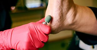 Mutuelle santé senior avec prise en charge pédicure et podologue : prix et devis